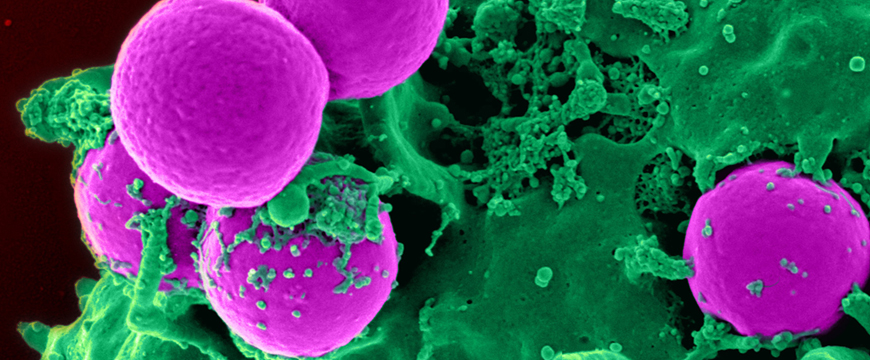 Microscopic MRSA